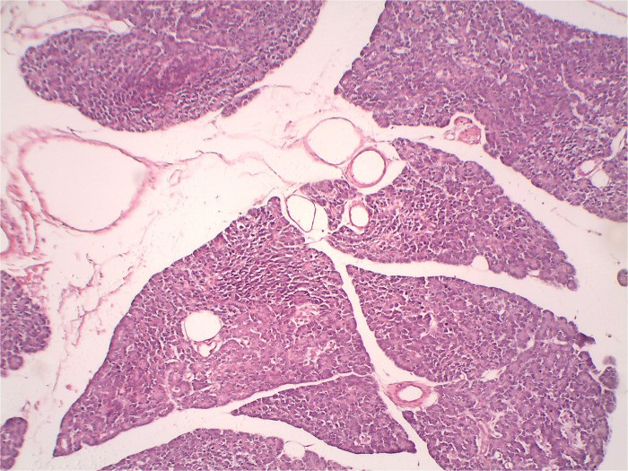 pancreas-33